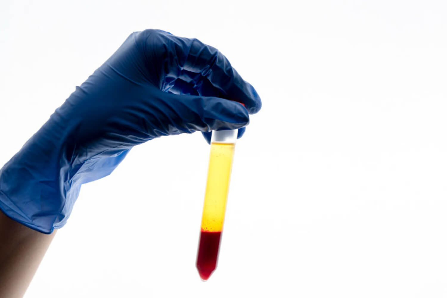 cannabis blood test